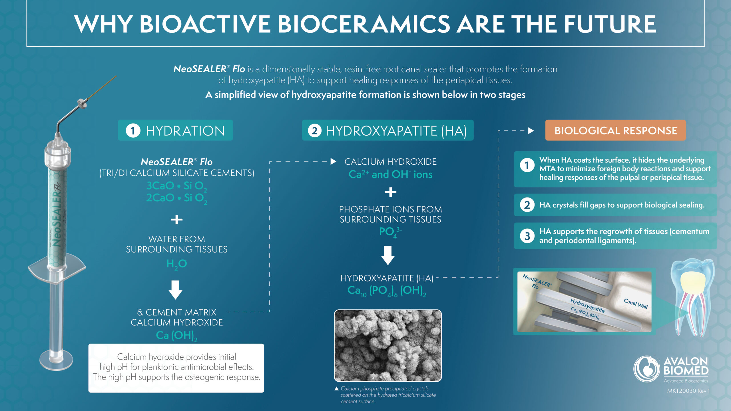 AvalonBiomed_NeoSEALERFlo_Dom_Hydroxyapatite_Infographic-scaled.jpg